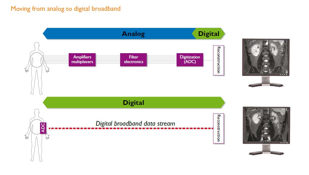 dstream moving from analog to digital broadband