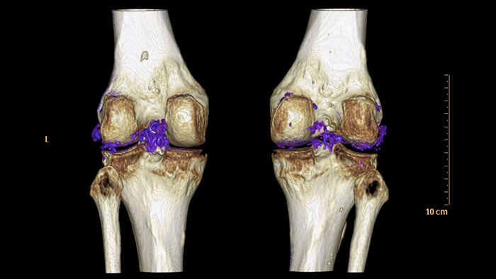 hi av category update april ct ct dual energy viewer