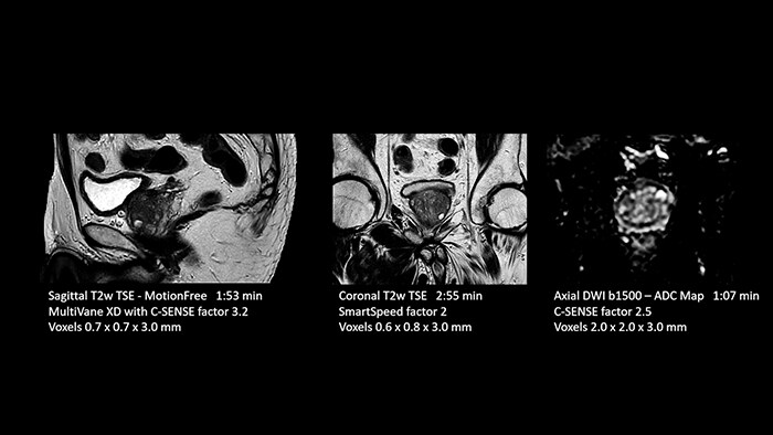 Prostate image two