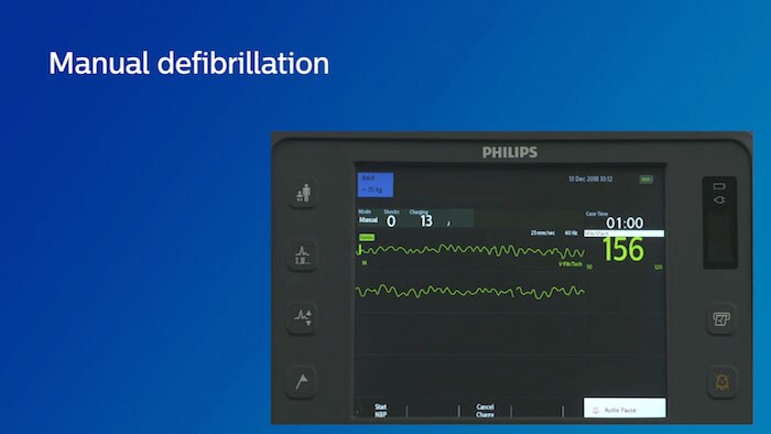 Manuel defibrillation video