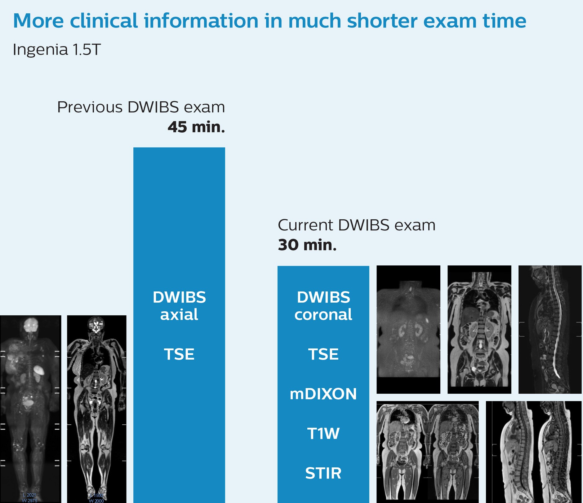 whole body mri use in oncology patients faster whole body mri kawasaki