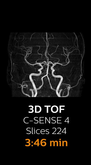 3D TOF image