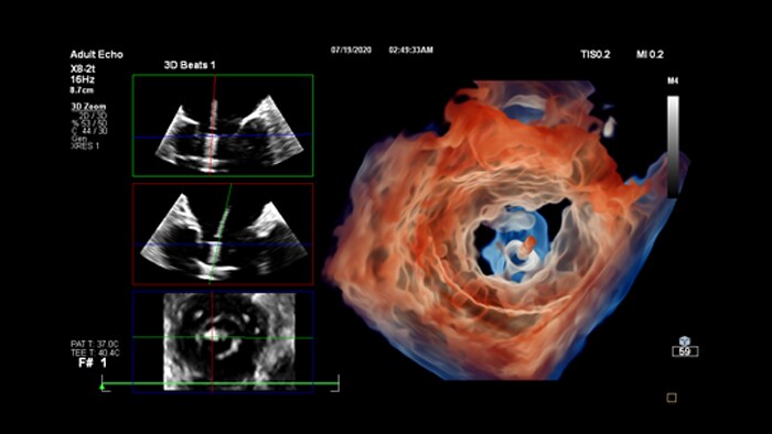 Cardiac advanced technology