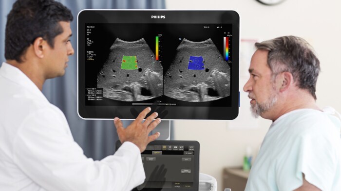 Liver Ultrasound