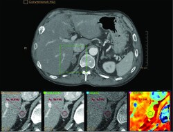 clinical image